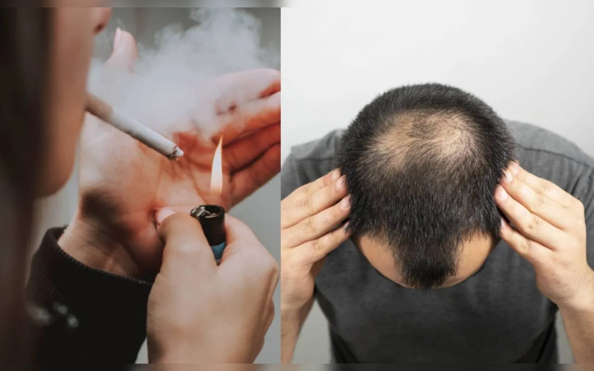 Do Smokers Lose Hair? Is There A Connection?