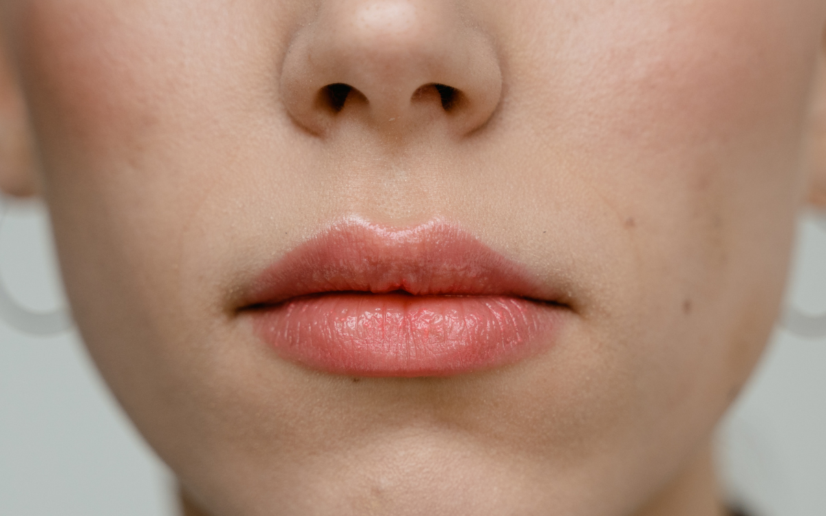 How Can I Have Soft Lips?